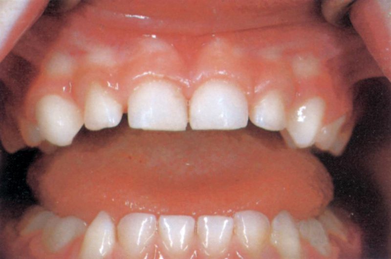 healthy-teeth
