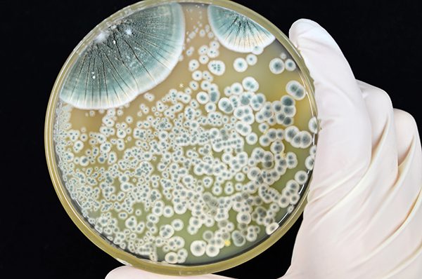 Colonies of Penicillium mold growing on agar plate