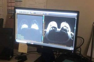 Herston Imaging Research Facility (HIRF) is a highly specialised imaging centre 