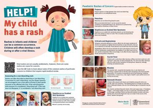 Rash poster