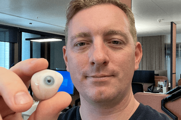man holding prosthetic eye